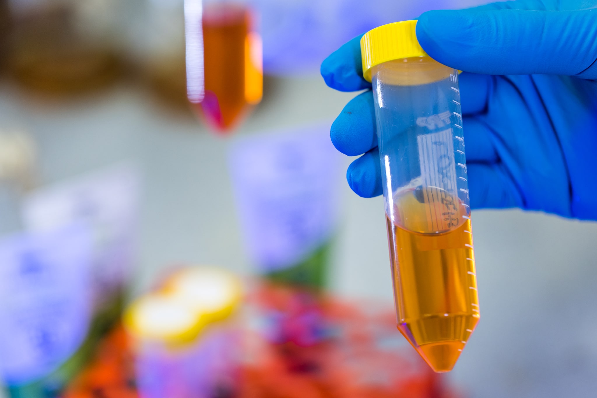 Hand holding a container with yellowish liquid