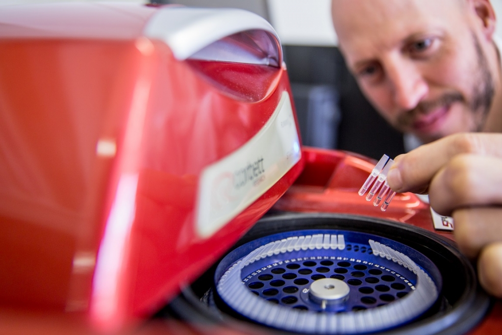 Hand holding a container with yellowish liquid