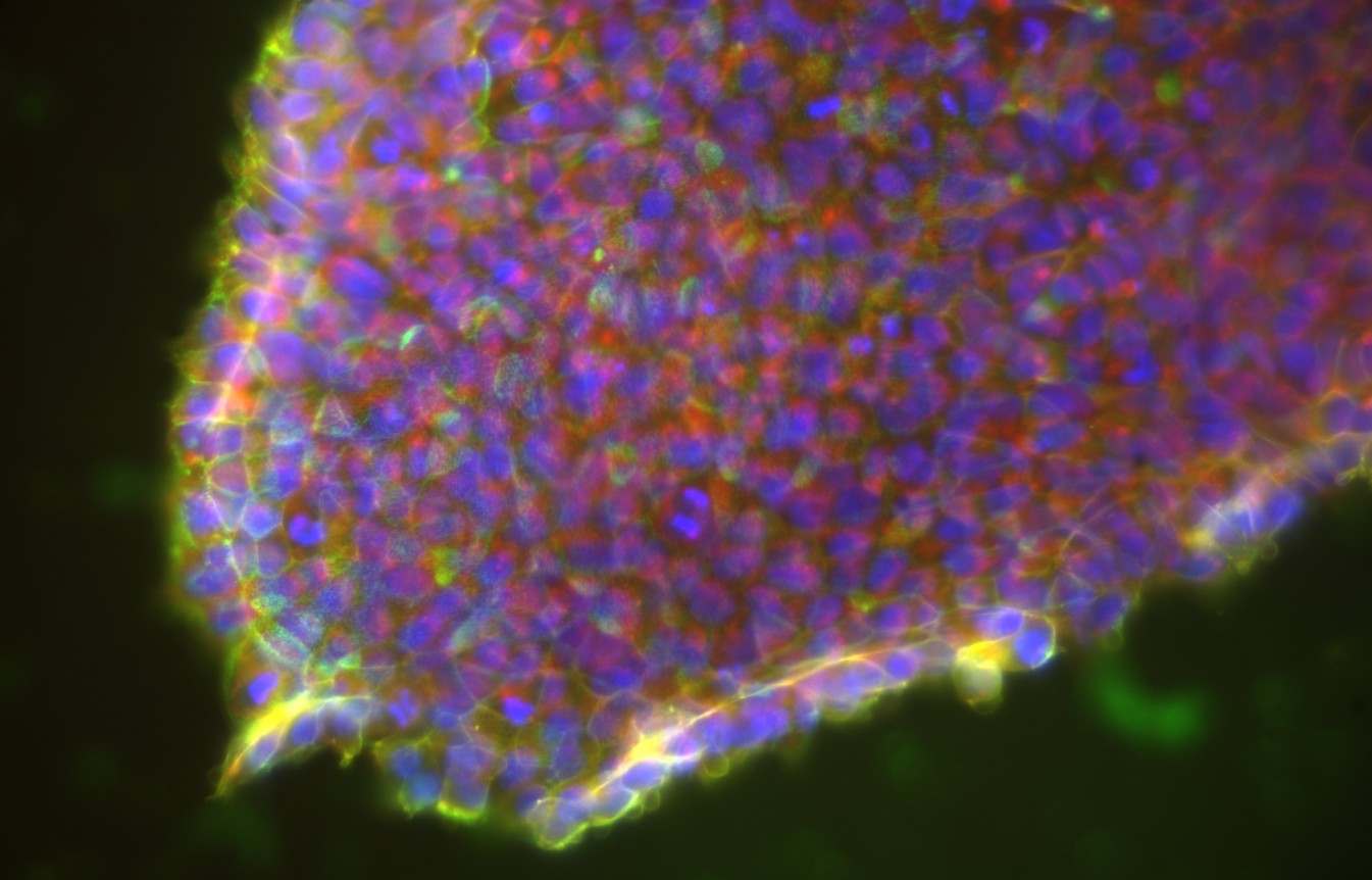 Transcriptomics and Genomics