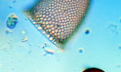 Phytoplankton under the microscope 